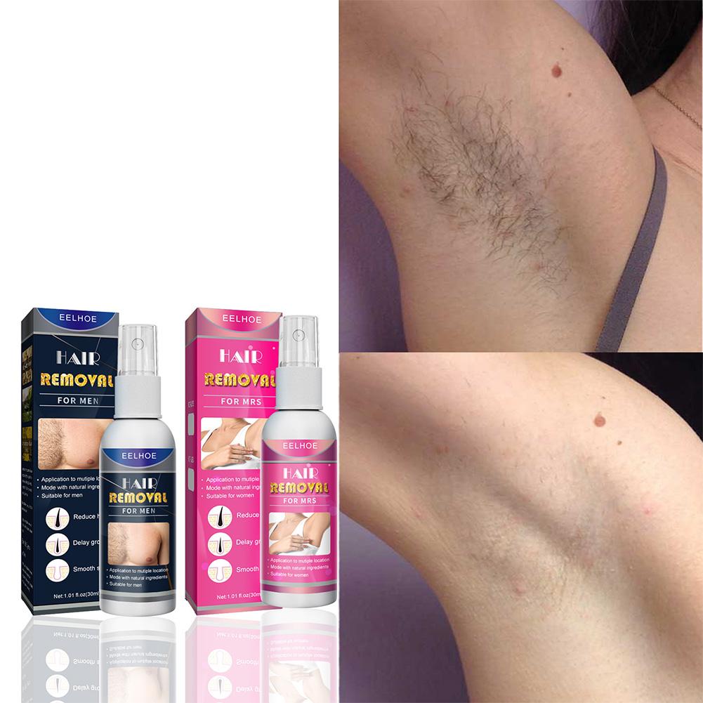Épilateur Permanent indolore S - Women Accessories Clearance avis et prix